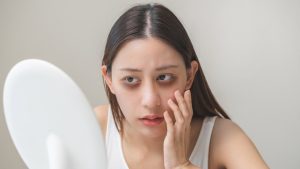 remove dark circles